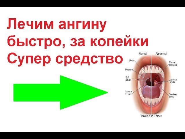 Лучшее и безопасное средство от ангины 100%