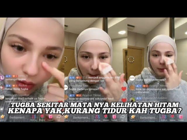 TUGBA SEKITAR MATA NYA KELIHATAN HITAM,KENAPA YA? KURANG TIDUR KAH TUGBA?