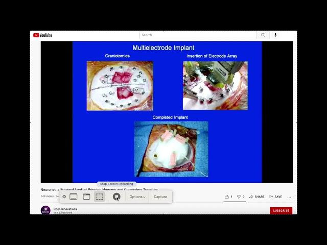 Clip - Monkey Brain Machine Interface With Neuron Mapping Michael Lebedev, Duke Medical Center, 2014