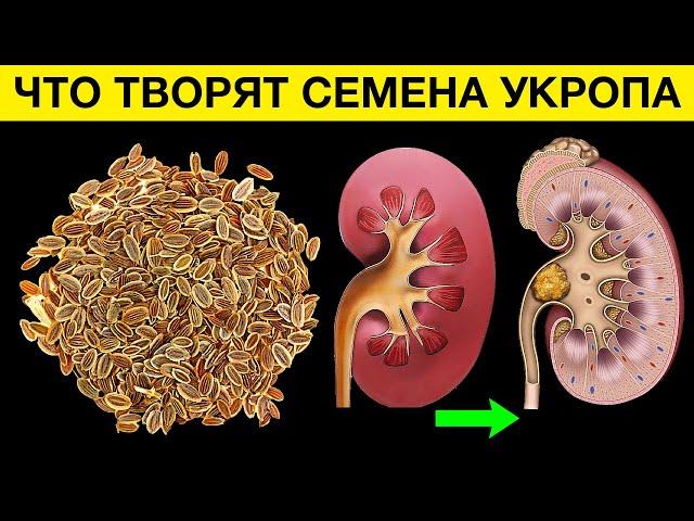 Что СЕМЕНА УКРОПА сделали с моими ПОЧКАМИ. Что творят семена укропа? Больше вреда, чем пользы?