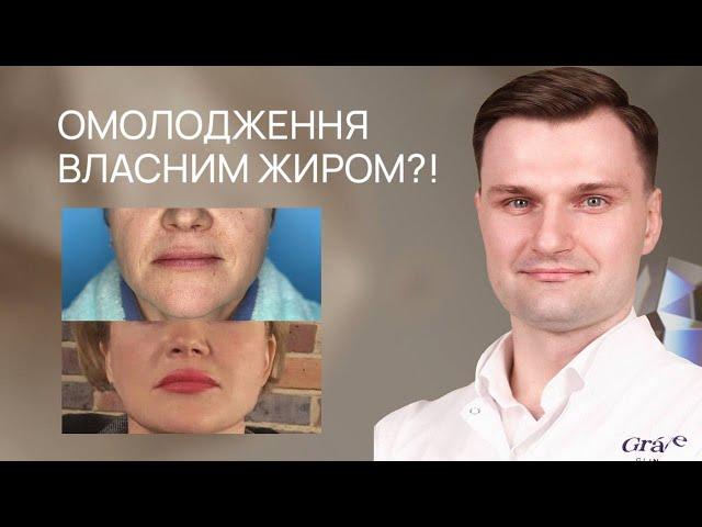 ЛІПОФІЛІНГ ОБЛИЧЧЯ: молодження власним жиром Grace Clinic