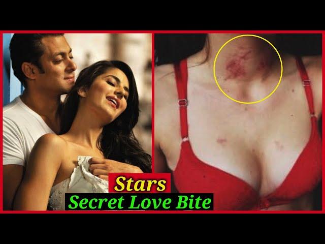 Bollywood Stars Who Were Caught Red Handed With Their Love Bites | You Never Noticed