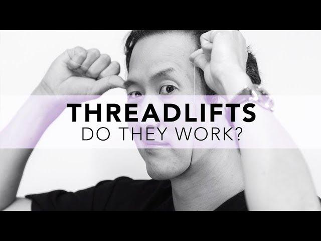 What is the REAL truth about Threadlifts? No spin here!