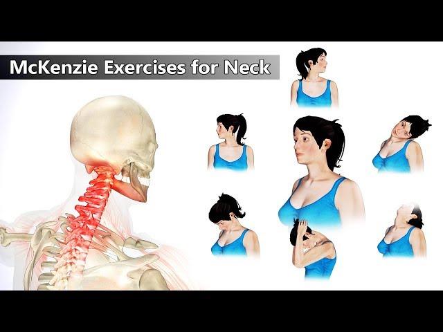 6 Mckenzie Exercises for Neck Pain Relief