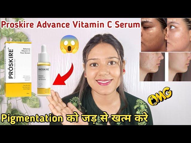 ProSKire Vitamin C Serum Review,proskire vitamin c serum 2024|proskire vitamin c serum how to use