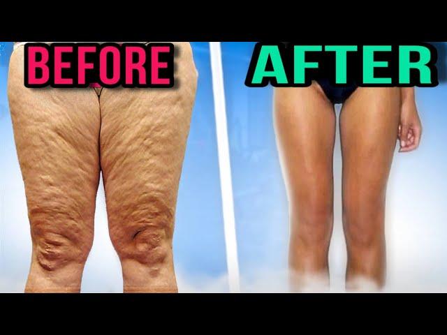 How to get rid of thighs? Top 3 exercises for inner part of thighs for legs' weight loss