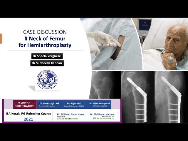 Fracture neck of femur for hemiarthroplasty - Case Discussion | Kerala ISA PG Refresher Course 2021