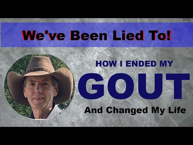 Gout Free after 30 years of PAIN! Everything I was told is WRONG!