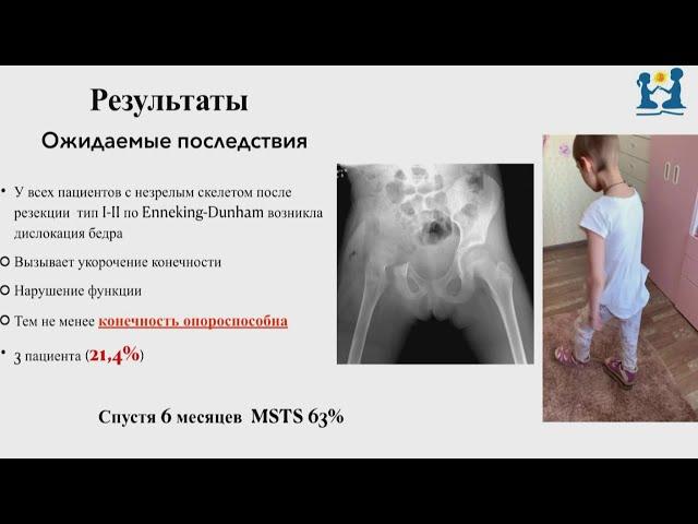 Pelvic resections in children and adolescents (Nikolai Bolshakov)