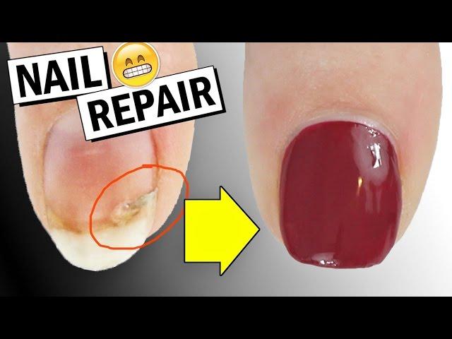 HOW TO REPAIR A BROKEN NAIL + DID IT WORK? | Nailed It NZ