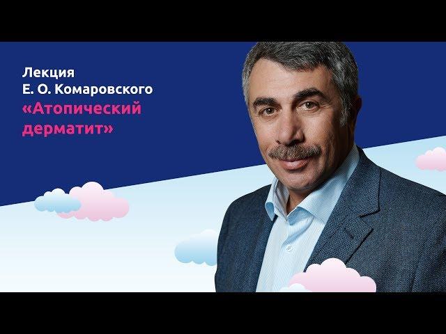 Атопический дерматит - Доктор Комаровский