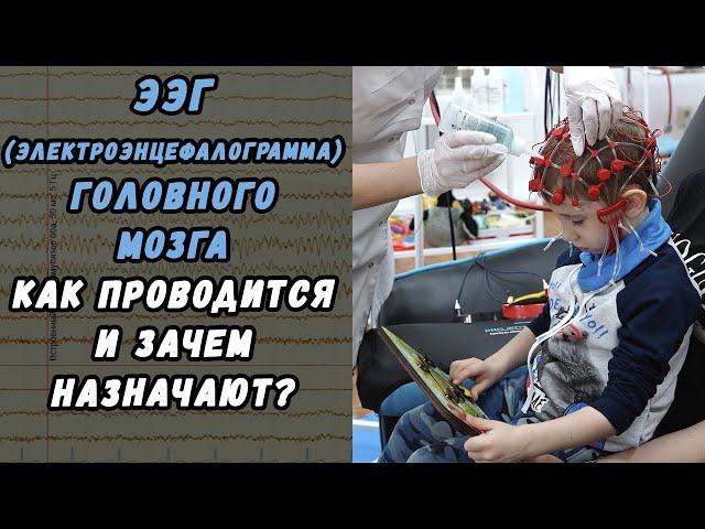 СДЕЛАТЬ ЭЭГ РЕБЕНКУ В ХАБАРОВСКЕ