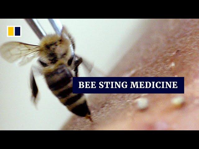 Bee sting as medicine: Syrians turn to apitherapy for alternative treatment