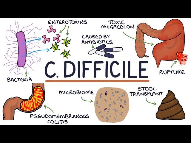 Understanding Clostridium Difficile Infection (C. Diff)
