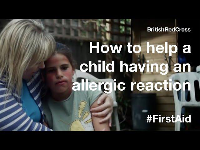 How to help a child suffering an allergic reaction #FirstAid #PowerOfKindness