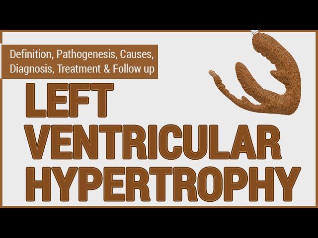 Left Ventricular Hypertrophy (LVH) - What is LVH, and how is it diagnosed & managed?