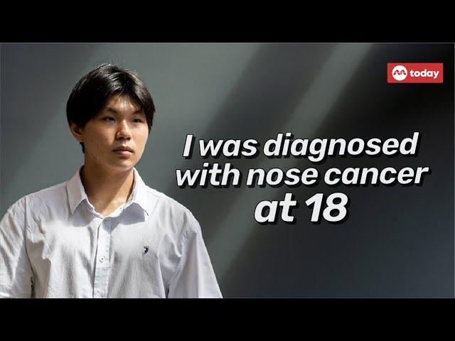 I was diagnosed with nose cancer at 18