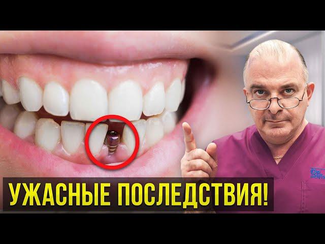 Самые ЧАСТЫЕ жалобы после ИМПЛАНТАЦИИ зубов! Важно знать!