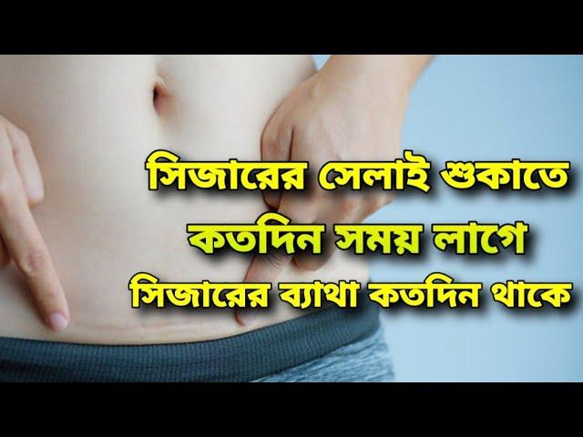 সিজারের সেলাই শুকাতে কতদিন লাগে|সিজারের ব্যাথা কতদিন থাকে|সিজারের পর কি কি খাওয়া যাবেনা|Sijarer
