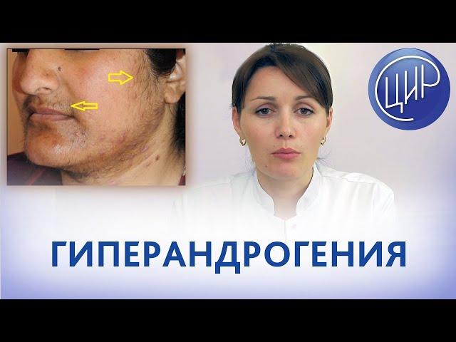 ГИПЕРАНДРОГЕНИЯ и бесплодие. Причины, симптомы и диагностика гиперандрогении. Дюльгер В.П.