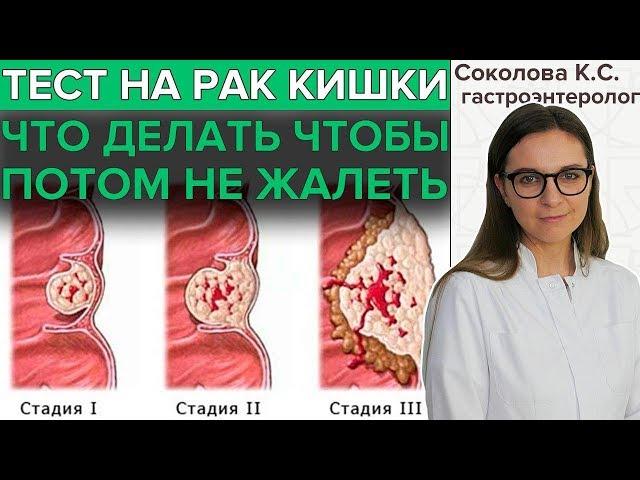 РАК ТОЛСТОЙ ИЛИ ПРЯМОЙ КИШКИ | Скрининг колоректального рака