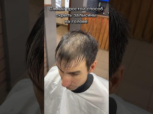 Мужская стрижка с залысинами на голове ️