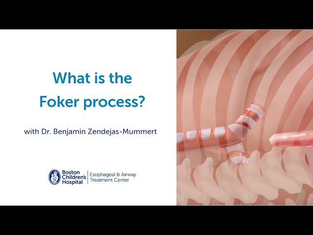 What is the Foker process?