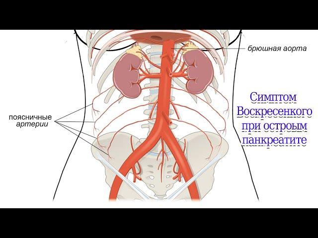 Симптом Воскресенкого при остром панкреатите #симптом #острый #панкреатит #пульс #аорта