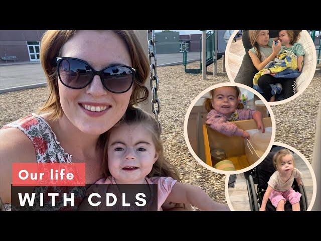 Our life with a rare disease Cornelia de Lange Syndrome