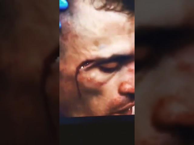 Huge Cut On Douglas Silva De Andrade