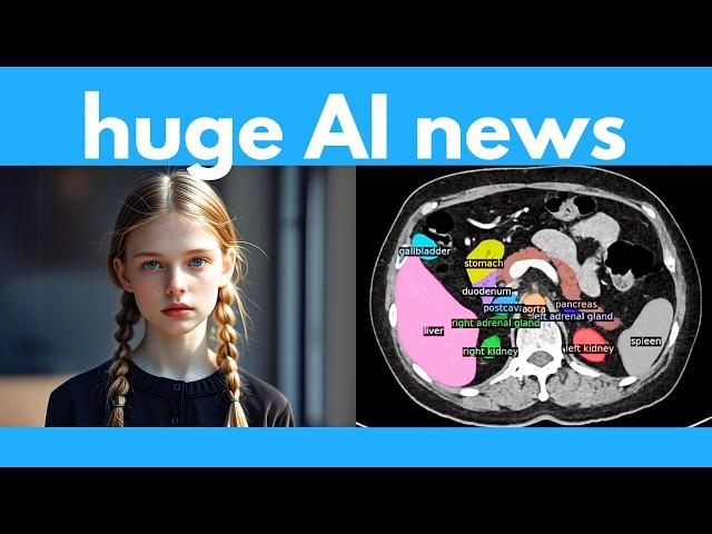 AI full video control, Infinite 3D worlds, AI finds cancer, FLUX tools, Open-source model beats o1