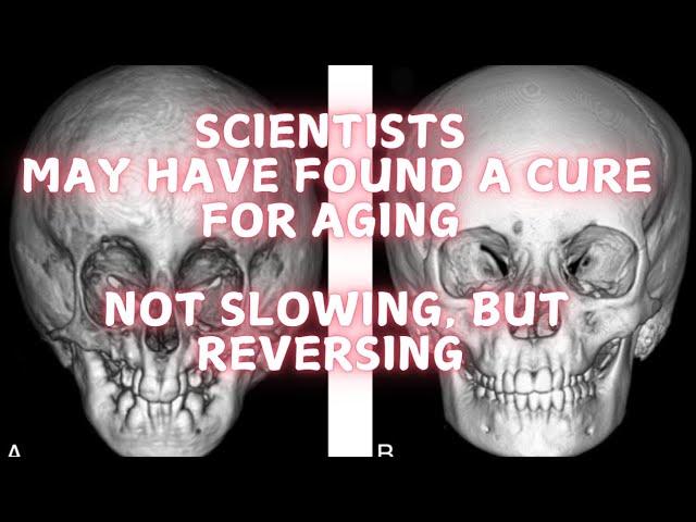 Scientists may have found a cure for aging