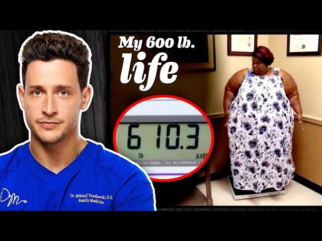 The Brutal Reality of Life At 600+ Pounds