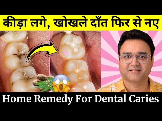 दांत में लगा कीड़ा, खोखला दांत फिर से नए जैसा | Remedy For Tooth Cavity | Dental Caries