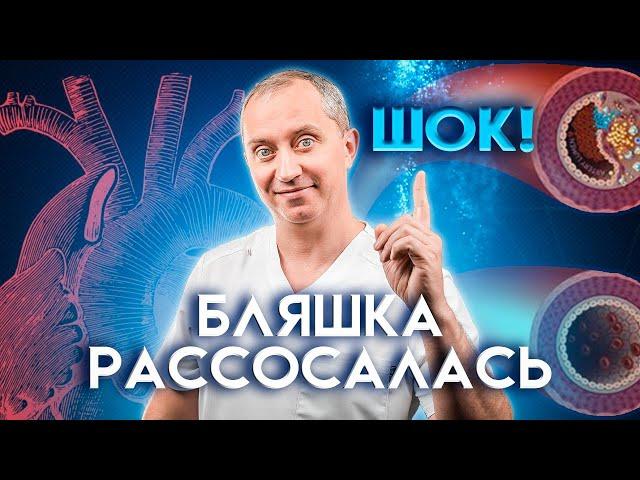 Шок! Бляшка рассосалась! Атеросклероз