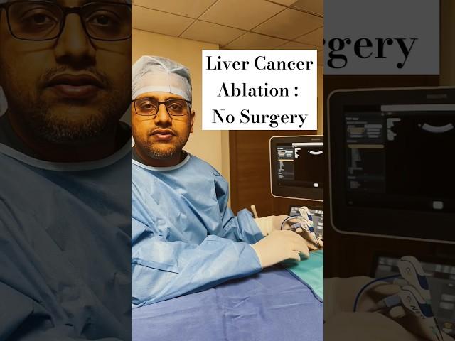 Liver Cancer Cure by Ablation: No Surgery !!    #shorts #ytshorts #youtubeshorts #Doctorinkerala