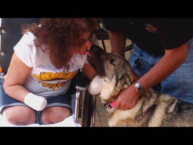 Woman Who Lost Limbs After Dog Lick Still Loves Her