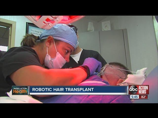 Robotic hair transplant