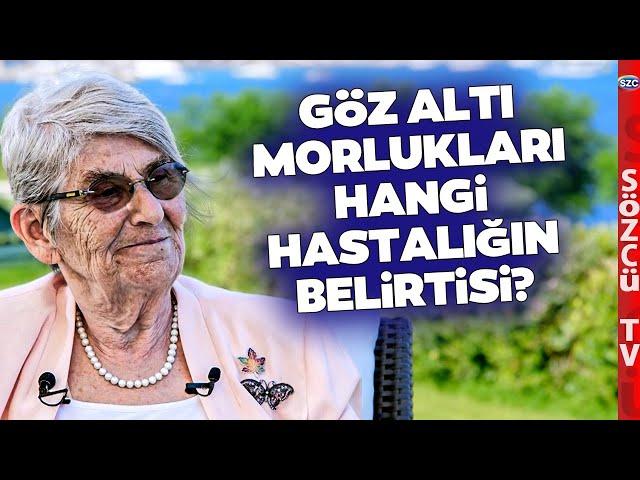 Göz Altı Morlukları Neden Olur? Canan Karatay 'Çok Büyük Belirti' Diyerek Anlattı