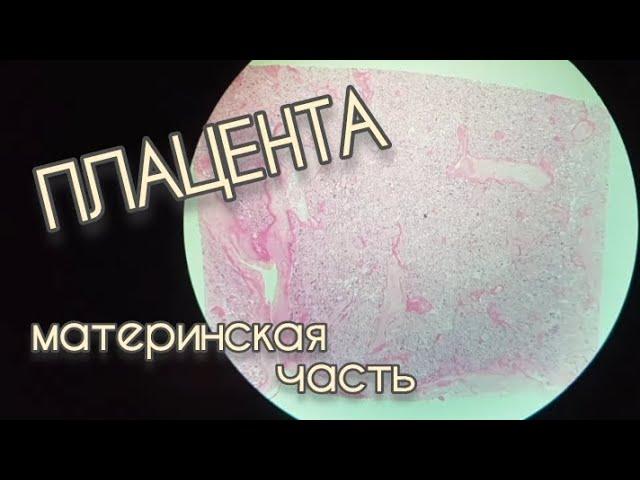 ПЛАЦЕНТА материнская часть (гистопрепарат)