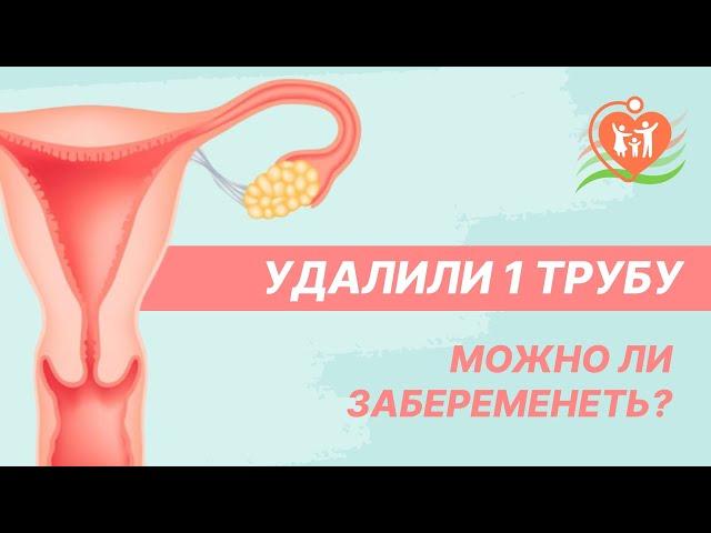  Удалили 1 трубу - можно ли забеременеть?