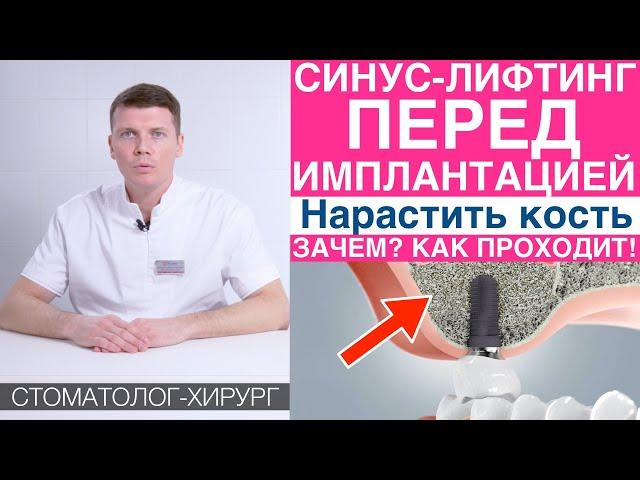 Синус-лифтинг - наращивание костной ткани перед имплантацией зубов. Установка зубных имплантов.