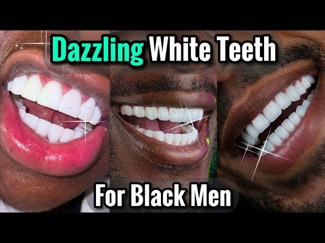 How to Get a Dazzling White Smile for Black Men