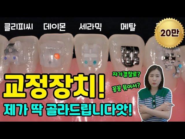 다양한 치아교정 장치! 내 치아에 맞는 장치는 따로 있다고?