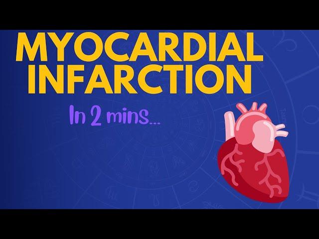 Myocardial Infarction in 2 mins!