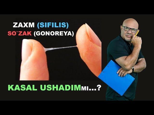 #155 FOXISHADAN KASAL USHADIMmi...? ZAXM, SO'ZAK