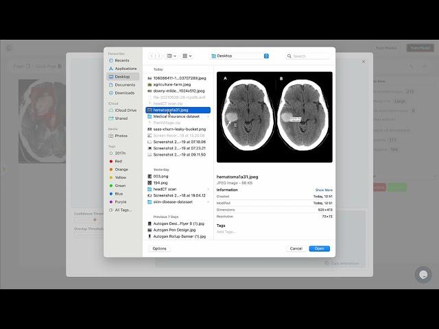 Autogon LabelCraft On Brain CT Scan