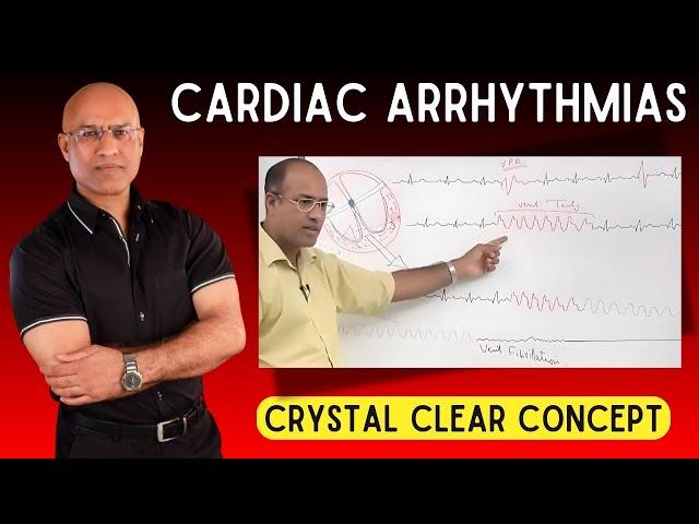 Cardiac Arrhythmias | Tachycardia and Bradycardia | Cardiology