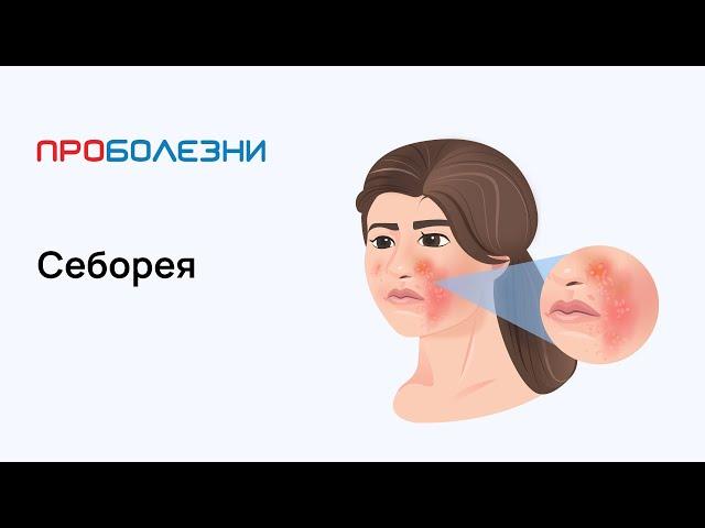 Себорея