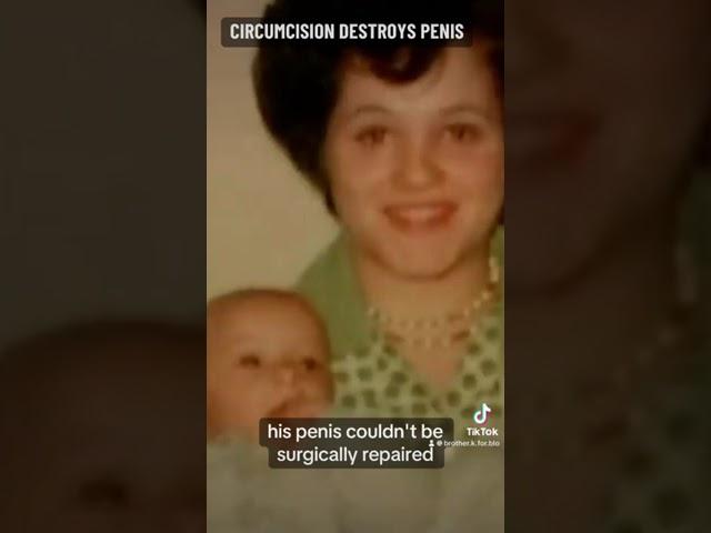 CIRCUMCISION DESTROYED HIS PENIS